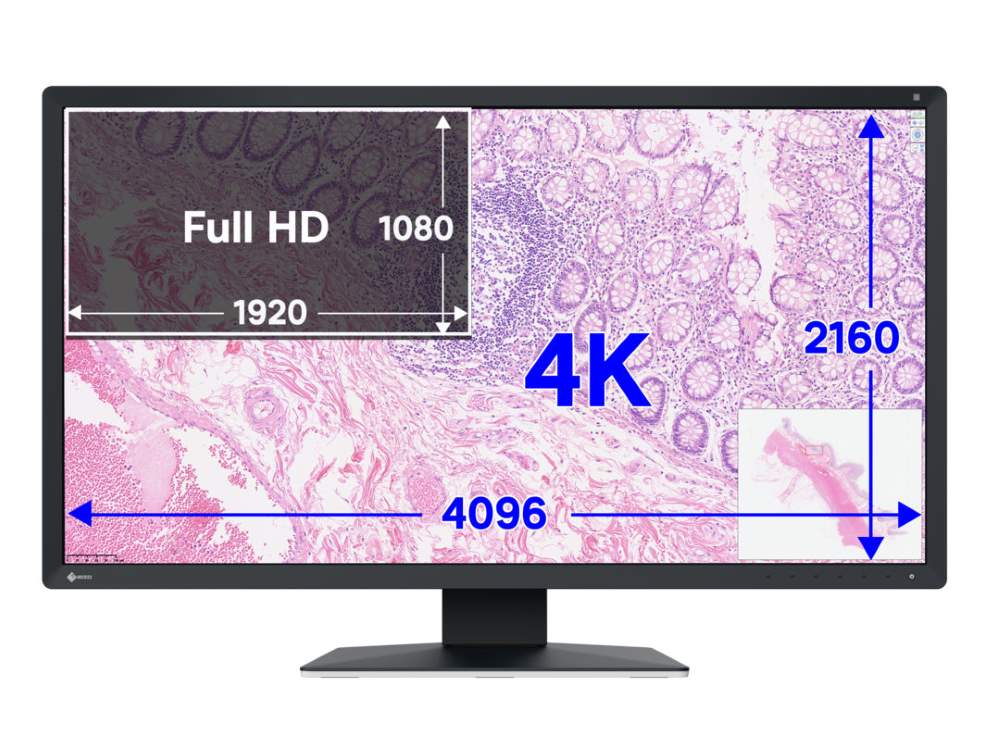 Eizo PX3150 01